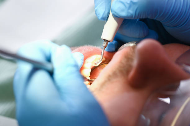 Best Emergency Dentist for Lost Fillings or Crowns in Hennessey, OK