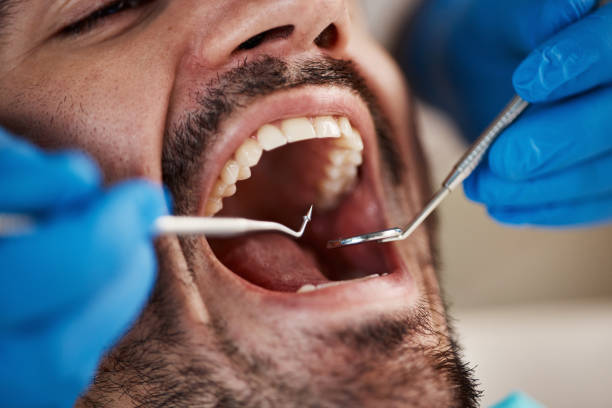 Best Urgent Dental Care for Toothache in Hennessey, OK